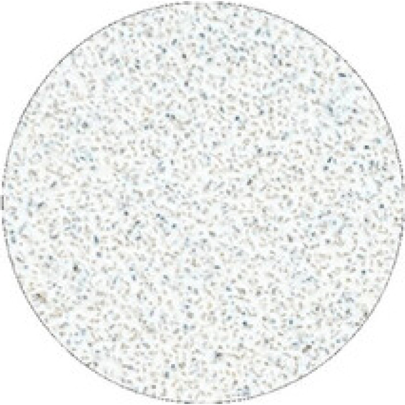 Staleks Pro L hrubost 80 White Refill Pads for Pedicure Disc - N&aacute;hradn&iacute; brusn&yacute; pap&iacute;r pro pedik&eacute;rsk&yacute; kotouč 50 ks