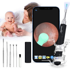 BlumWay Ausu otoskops